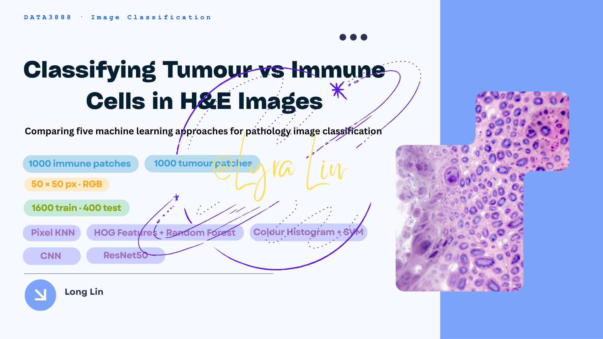 H&E Tumour vs Immune Cells